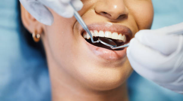 Best Emergency Tooth Extraction in St Clair Shores, MI