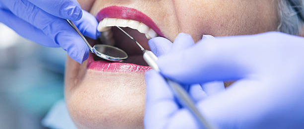 Best Emergency Tooth Extraction in St Clair Shores, MI